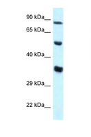 ZNF232 Antibody - ZNF232 antibody Western blot of HepG2 Cell lysate. Antibody concentration 1 ug/ml.  This image was taken for the unconjugated form of this product. Other forms have not been tested.