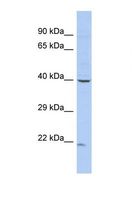 ZNF232 Antibody - Western blot of Human COLO205. ZNF232 antibody dilution 1.0 ug/ml.  This image was taken for the unconjugated form of this product. Other forms have not been tested.