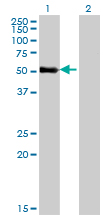 ZNF232 Antibody - Western blot of ZNF232 expression in transfected 293T cell line by ZNF232 monoclonal antibody (M06), clone 1F8.