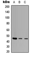 ZNF232 Antibody - Western blot analysis of ZNF232 expression in HEK293T (A); NS-1 (B); H9C2 (C) whole cell lysates.
