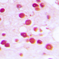 ZNF232 Antibody - Immunohistochemical analysis of ZNF232 staining in human testis formalin fixed paraffin embedded tissue section. The section was pre-treated using heat mediated antigen retrieval with sodium citrate buffer (pH 6.0). The section was then incubated with the antibody at room temperature and detected using an HRP-conjugated compact polymer system. DAB was used as the chromogen. The section was then counterstained with hematoxylin and mounted with DPX.
