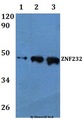ZNF232 Antibody - Western blot of ZNF232 antibody at 1:500 Line1:HEK293T whole cell lysate Line2:H9C2 whole cell lysate Line3:sp20 whole cell lysate.
