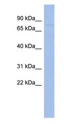 ZNF233 Antibody - ZNF233 antibody Western Blot of Human Thymus.  This image was taken for the unconjugated form of this product. Other forms have not been tested.