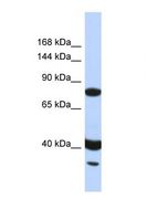 ZNF235 Antibody - Western blot of Human HeLa. ZNF235 antibody dilution 1.0 ug/ml.  This image was taken for the unconjugated form of this product. Other forms have not been tested.