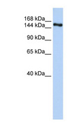 ZNF236 Antibody - ZNF236 antibody Western blot of Fetal Brain lysate. This image was taken for the unconjugated form of this product. Other forms have not been tested.