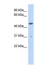 ZNF238 Antibody - ZNF238 antibody Western blot of Fetal Pancreas lysate. This image was taken for the unconjugated form of this product. Other forms have not been tested.