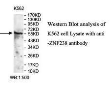 ZNF238 Antibody