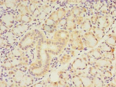 ZNF238 Antibody - Immunohistochemistry of paraffin-embedded human pancreatic tissue using antibody at dilution of 1:100.