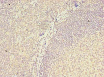 ZNF238 Antibody - Immunohistochemistry of paraffin-embedded human tonsil tissue using ZBTB18 Antibody at dilution of 1:100