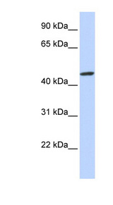 ZNF239 Antibody - ZNF239 antibody Western blot of Fetal Brain lysate. This image was taken for the unconjugated form of this product. Other forms have not been tested.