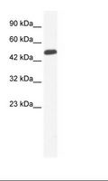 ZNF239 Antibody - Jurkat Cell Lysate.  This image was taken for the unconjugated form of this product. Other forms have not been tested.