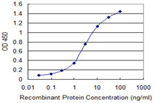 ZNF239 Antibody - Detection limit for recombinant GST tagged ZNF239 is 0.03 ng/ml as a capture antibody.