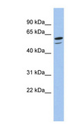 ZNF248 Antibody - ZNF248 antibody Western blot of COLO205 cell lysate. This image was taken for the unconjugated form of this product. Other forms have not been tested.