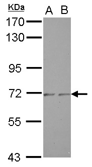 ZNF248 Antibody - Sample (30 ug of whole cell lysate) A: A549 B: HeLa 7.5% SDS PAGE ZNF248 antibody diluted at 1:1000