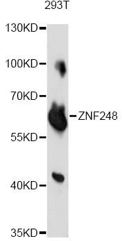 ZNF248 Antibody - Western blot analysis of extracts of 293T cells, using ZNF248 antibody at 1:1000 dilution. The secondary antibody used was an HRP Goat Anti-Rabbit IgG (H+L) at 1:10000 dilution. Lysates were loaded 25ug per lane and 3% nonfat dry milk in TBST was used for blocking. An ECL Kit was used for detection and the exposure time was 10s.