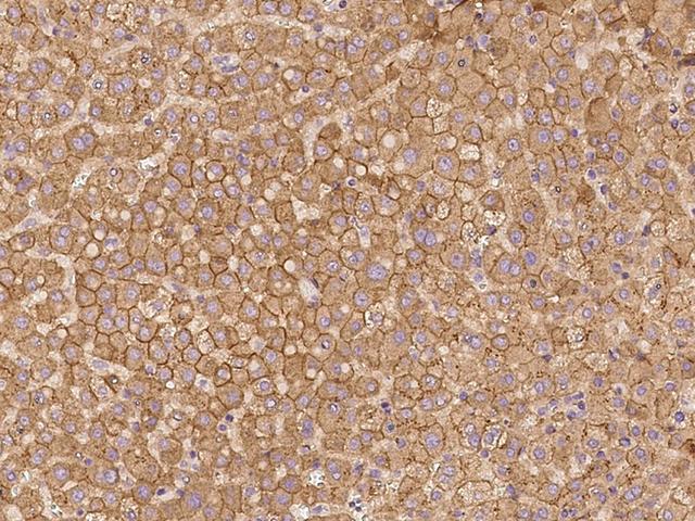 ZNF248 Antibody - Immunochemical staining of human ZNF248 in human liver with rabbit polyclonal antibody at 1:100 dilution, formalin-fixed paraffin embedded sections.