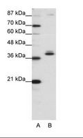 ZNF25 Antibody - A: Marker, B: HepG2 Cell Lysate.  This image was taken for the unconjugated form of this product. Other forms have not been tested.