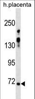 ZNF251 Antibody - ZNF251 Antibody western blot of human placenta tissue lysates (35 ug/lane). The ZNF251 antibody detected the ZNF251 protein (arrow).