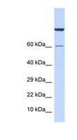ZNF251 Antibody - ZNF251 antibody Western blot of Fetal Muscle lysate. This image was taken for the unconjugated form of this product. Other forms have not been tested.