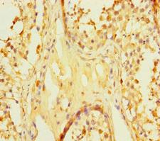 ZNF252P-AS1 Antibody - Immunohistochemistry of paraffin-embedded human testis tissue using ZNF252P-AS1 Antibody at dilution of 1:100