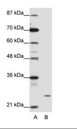 ZNF253 Antibody - A: Marker, B: HepG2 Cell Lysate.  This image was taken for the unconjugated form of this product. Other forms have not been tested.