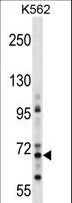 ZNF256 Antibody - ZNF256 Antibody western blot of K562 cell line lysates (35 ug/lane). The ZNF256 antibody detected the ZNF256 protein (arrow).