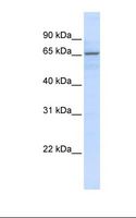 ZNF256 Antibody - MCF7 cell lysate. Antibody concentration: 1.0 ug/ml. Gel concentration: 12%.  This image was taken for the unconjugated form of this product. Other forms have not been tested.