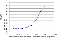 ZNF256 Antibody - Detection limit for recombinant GST tagged ZNF256 is approximately 0.3 ng/ml as a capture antibody.