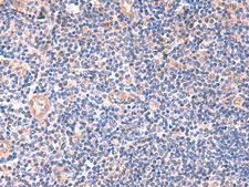 ZNF256 Antibody - Immunohistochemistry of paraffin-embedded Human tonsil tissue  using ZNF256 Polyclonal Antibody at dilution of 1:120(×200)