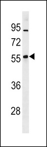 ZNF260 Antibody - Mouse Znf260 Antibody western blot of mouse lung tissue lysates (35 ug/lane). The Mouse Znf260 antibody detected the Mouse Znf260 protein (arrow).