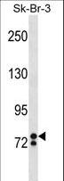 ZNF263 Antibody - ZNF263 Antibody western blot of SK-BR-3 cell line lysates (35 ug/lane). The ZNF263 antibody detected the ZNF263 protein (arrow).