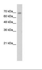 ZNF264 Antibody - Jurkat Cell Lysate.  This image was taken for the unconjugated form of this product. Other forms have not been tested.