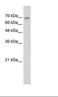 ZNF264 Antibody - Jurkat Cell Lysate.  This image was taken for the unconjugated form of this product. Other forms have not been tested.