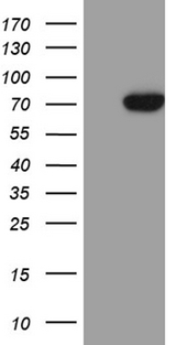 ZNF264 Antibody - HEK293T cells were transfected with the pCMV6-ENTRY control. (Left lane) or pCMV6-ENTRY ZNF264. (Right lane) cDNA for 48 hrs and lysed