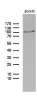 ZNF264 Antibody - Western blot analysis of extracts. (35ug) from Jurkat cell lines by using anti-ZNF264 monoclonal antibody. (1:500)