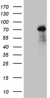 ZNF264 Antibody - HEK293T cells were transfected with the pCMV6-ENTRY control. (Left lane) or pCMV6-ENTRY ZNF264. (Right lane) cDNA for 48 hrs and lysed. Equivalent amounts of cell lysates. (5 ug per lane) were separated by SDS-PAGE and immunoblotted with anti-ZNF264. (1:2000)