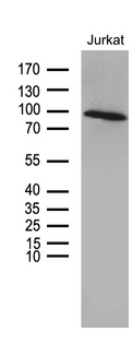 ZNF264 Antibody - Western blot analysis of Jurkat cell lysate. (35ug) by using anti-ZNF264 monoclonal antibody. (1:500)