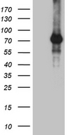 ZNF264 Antibody - HEK293T cells were transfected with the pCMV6-ENTRY control. (Left lane) or pCMV6-ENTRY ZNF264. (Right lane) cDNA for 48 hrs and lysed