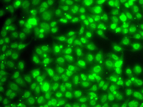 ZNF264 Antibody - Immunofluorescence analysis of A549 cells.