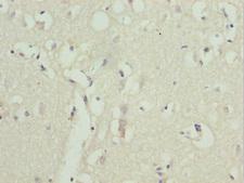 ZNF264 Antibody - Immunohistochemistry of paraffin-embedded human brain tissue at dilution 1:100
