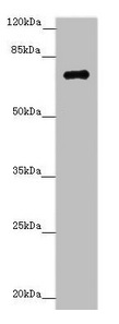 ZNF264 Antibody - Western blot All lanes: ZNF264 antibody at 1.02µg/ml + Jurkat whole cell lysate Secondary Goat polyclonal to rabbit IgG at 1/10000 dilution Predicted band size: 71 kDa Observed band size: 71 kDa