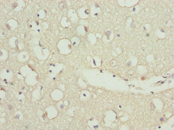 ZNF264 Antibody - Immunohistochemistry of paraffin-embedded human brain tissue at dilution 1:100
