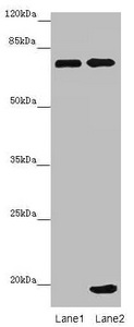 ZNF264 Antibody - Western blot All Lanes: ZNF264 antibody at 2.07ug/ml Lane 1: Jurkat whole cell lysate Lane 2: 293T whole cell lysate Secondary Goat polyclonal to Rabbit IgG at 1/10000 dilution Predicted band size: 71 kDa Observed band size: 71,19 kDa