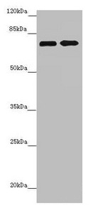 ZNF264 Antibody - Western blot All lanes: ZNF264 antibody at 2.07µg/ml Lane 1: Jurkat whole cell lysate Lane 2: 293T whole cell lysate Secondary Goat polyclonal to rabbit IgG at 1/10000 dilution Predicted band size: 71 kDa Observed band size: 71 kDa