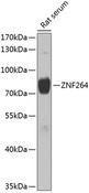 ZNF264 Antibody - Western blot analysis of extracts of rat serum using ZNF264 Polyclonal Antibody at dilution of 1:1000.