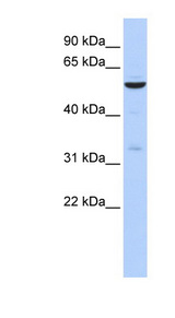 ZNF266 Antibody - ZNF266 antibody Western blot of 721_B cell lysate. This image was taken for the unconjugated form of this product. Other forms have not been tested.
