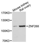 ZNF268 Antibody - Western blot analysis of extracts of various cell lines, using ZNF268 antibody at 1:3000 dilution. The secondary antibody used was an HRP Goat Anti-Rabbit IgG (H+L) at 1:10000 dilution. Lysates were loaded 25ug per lane and 3% nonfat dry milk in TBST was used for blocking. An ECL Kit was used for detection and the exposure time was 10s.