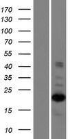 ZNF268 Protein - Western validation with an anti-DDK antibody * L: Control HEK293 lysate R: Over-expression lysate