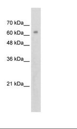 ZNF274 Antibody - Jurkat Cell Lysate.  This image was taken for the unconjugated form of this product. Other forms have not been tested.