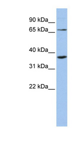 ZNF274 Antibody - ZNF274 antibody Western blot of MCF7 cell lysate. This image was taken for the unconjugated form of this product. Other forms have not been tested.